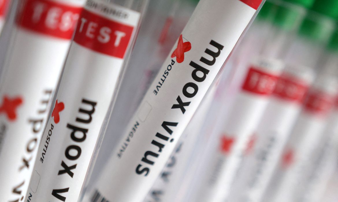 Reuters/Dado Ruvic/proibida a reprodução Teste positivo para Mpox
20, 2024. REUTERS/Dado Ruvic/Illustration